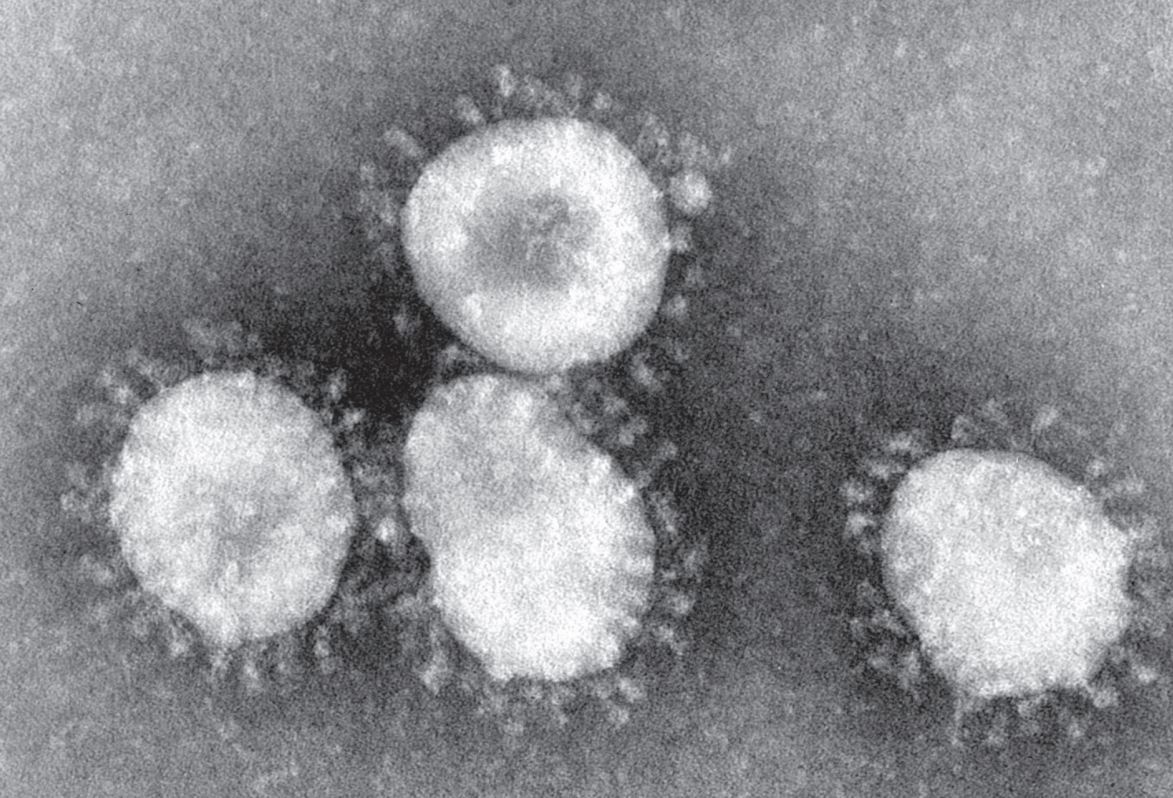 Opinion: I caught Covid-19, and here’s my experience