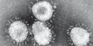 Opinion: I caught Covid-19, and here’s my experience